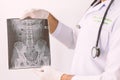 X-ray image of LS spine, AP view, show ankylosing spondylitis lumbar,Doctor examining a lung radiography, Doctor looking chest x-r