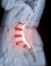 X-ray image of lumbar Spine  or L-s spine lateral view with MRI  l-s spine  for diagnosis lower back pain Royalty Free Stock Photo