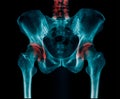X-ray image lumbar