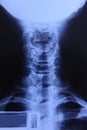 X-ray image neck Royalty Free Stock Photo