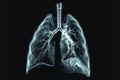 This x-ray image provides a detailed view of the human lungs, showcasing the anatomy and structure of the respiratory system, X- Royalty Free Stock Photo