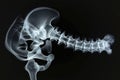 This x-ray image provides a detailed view of a human skeleton, showcasing the various bones, joints, and the spine, X-ray film of Royalty Free Stock Photo