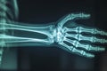 This x-ray image showcases a detailed view of a skeletons hand, capturing the structure and formation of the bones, A closer look Royalty Free Stock Photo
