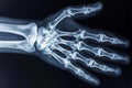 This x-ray image showcases the intricate structure of a skeleton hand in detailed clarity, A closer look at wrist bones through X- Royalty Free Stock Photo