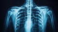 Detailed X-ray Image of Human Thorax and Spine in Medical Context Royalty Free Stock Photo