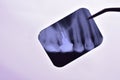 X-ray image of teeth in the hands of a doctor.Dental procedures concept. Royalty Free Stock Photo