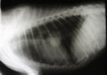 X-ray image of thorax with tumor