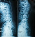 X-Ray image, View of neck men for medical diagnosis.