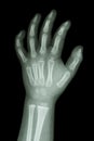 X-ray infant's hand Royalty Free Stock Photo