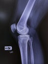 x-ray of knee joint side view. normal joint and space, Medical image concept Royalty Free Stock Photo