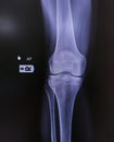 x-ray of knee joint side view. normal joint and space, Medical image concept Royalty Free Stock Photo