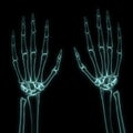 X-ray left and right hands Royalty Free Stock Photo