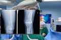 X-ray of leg and knee. Blurry Traumatology orthopedic surgery hospital emergency operating room for the leg broken operation.
