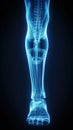 X-ray of legs of a male human, blue tone radiograph on a black background, Ai generative