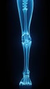 X-ray of legs of a male human, blue tone radiograph on a black background, Ai generative