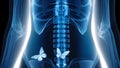 X-ray of a lover with butterflies in his stomach. Royalty Free Stock Photo