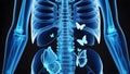 X-ray of a lover with butterflies in his stomach. Royalty Free Stock Photo