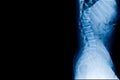 L-spine x-ray