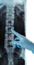 X-ray of lumbar spine classical radiology RTG blue glove pointed