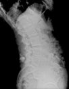 X-ray lumbo-sacral spine and pelvis. Examination scan