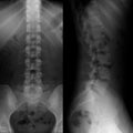 X-ray of the lumbosacral spine. Normal. Perfect.