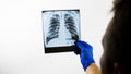 X-ray of the lungs in the doctor`s hands,the medical professional diagnoses the patient,examines the lungs in the picture,the doct Royalty Free Stock Photo