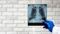 X-ray of the lungs in the hands of the doctor on the background of a white brick wall. Pneumonia of the lungs. diagnosis Royalty Free Stock Photo