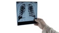 X-ray of the lungs in the hands of a doctor, diagnosis of lung disease. Picture of the lungs. isolated on white space for text for