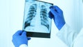 X-ray of the lungs to look at the light,the doctor is carefully examining the diagnosis,close-up