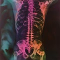 X-ray of a man with back pain, featuring a bright, vividly colored background.