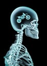 X-ray motocross fan