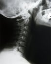X-Ray neck Royalty Free Stock Photo
