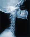 X-Ray of the Neck Royalty Free Stock Photo