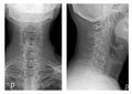 X-ray neck images Royalty Free Stock Photo
