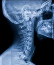 X-ray of the neck Royalty Free Stock Photo