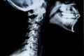 X ray neck and Jaw Royalty Free Stock Photo