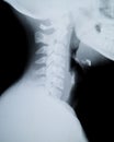 X ray neck and Jaw Royalty Free Stock Photo