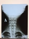 X-ray of neck in laboratory of clinic Royalty Free Stock Photo