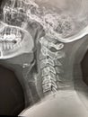 X-ray of a neck Royalty Free Stock Photo