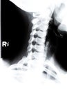 X ray neck and shoulder Royalty Free Stock Photo