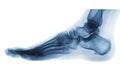 X-ray normal human foot . Lateral view .Invert color style .