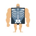 X-ray of person. Structure of men. Construct of athlete. Bones a