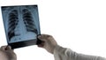 X-ray of a person  on white background. The doctor holds a human X-ray in his hands. Royalty Free Stock Photo