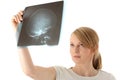 X-ray photo scan Royalty Free Stock Photo