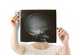 X-ray photo scan Royalty Free Stock Photo