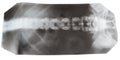 X-ray picture of human spinal column isolated