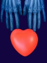 X-ray plate of the bones of the both human hands and red heart sign Royalty Free Stock Photo