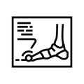 x-ray radiograph of foot gout diesase line icon vector illustration
