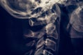 X-ray radiography or roentgen of human neck, medical radiology concept Royalty Free Stock Photo