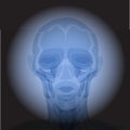 X Ray radiology. Royalty Free Stock Photo